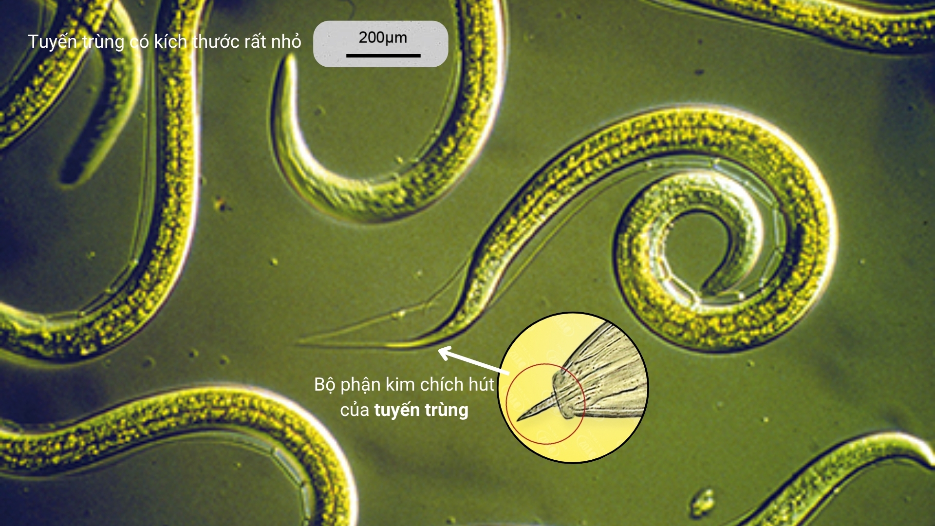 Tuyến trùng là gì?